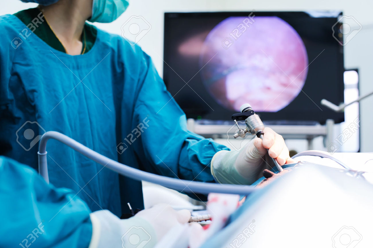 Chirurgie Laparoscopique